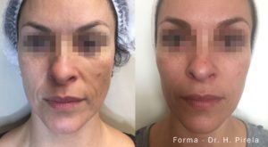 SM_Forma_2a_FT_Face-min